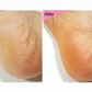 Esfolio foot & Heel Peeling mask